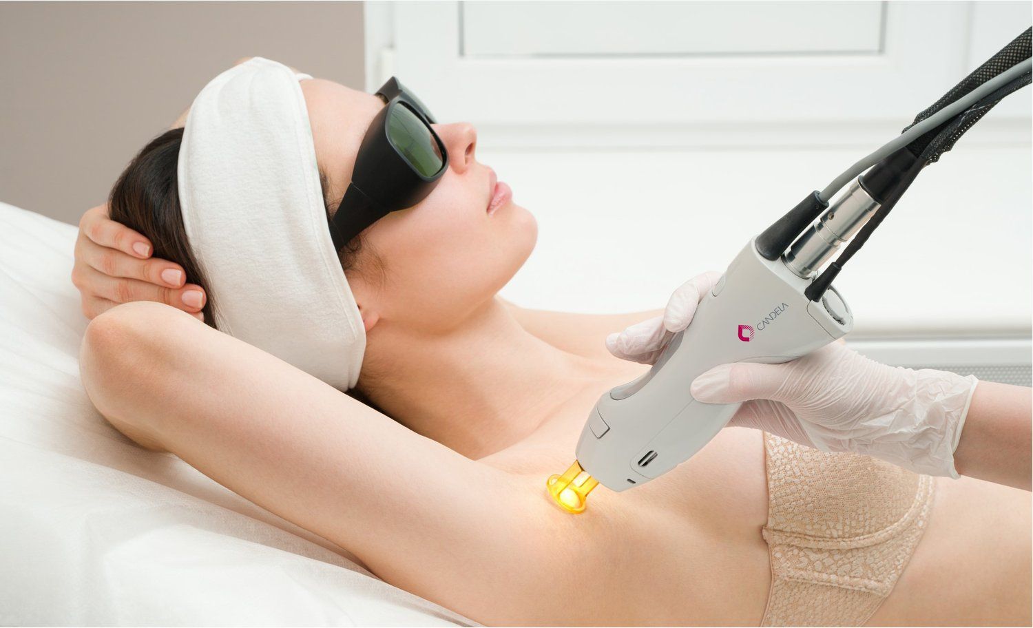 Laser hair removal